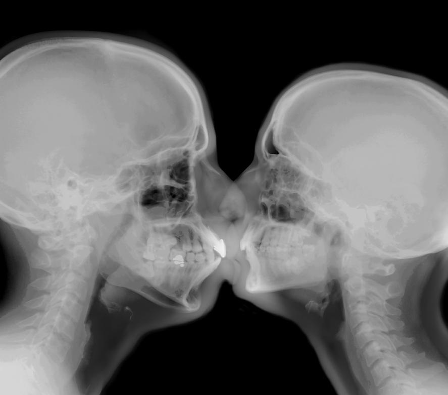 xray